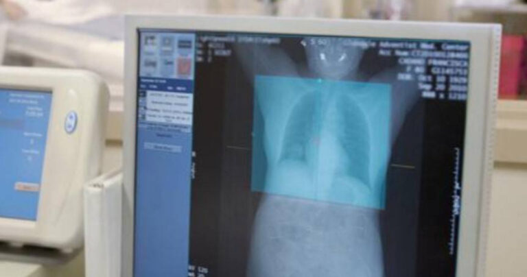 【流感2023】學童肺炎嚴重 父母仍堅持上課